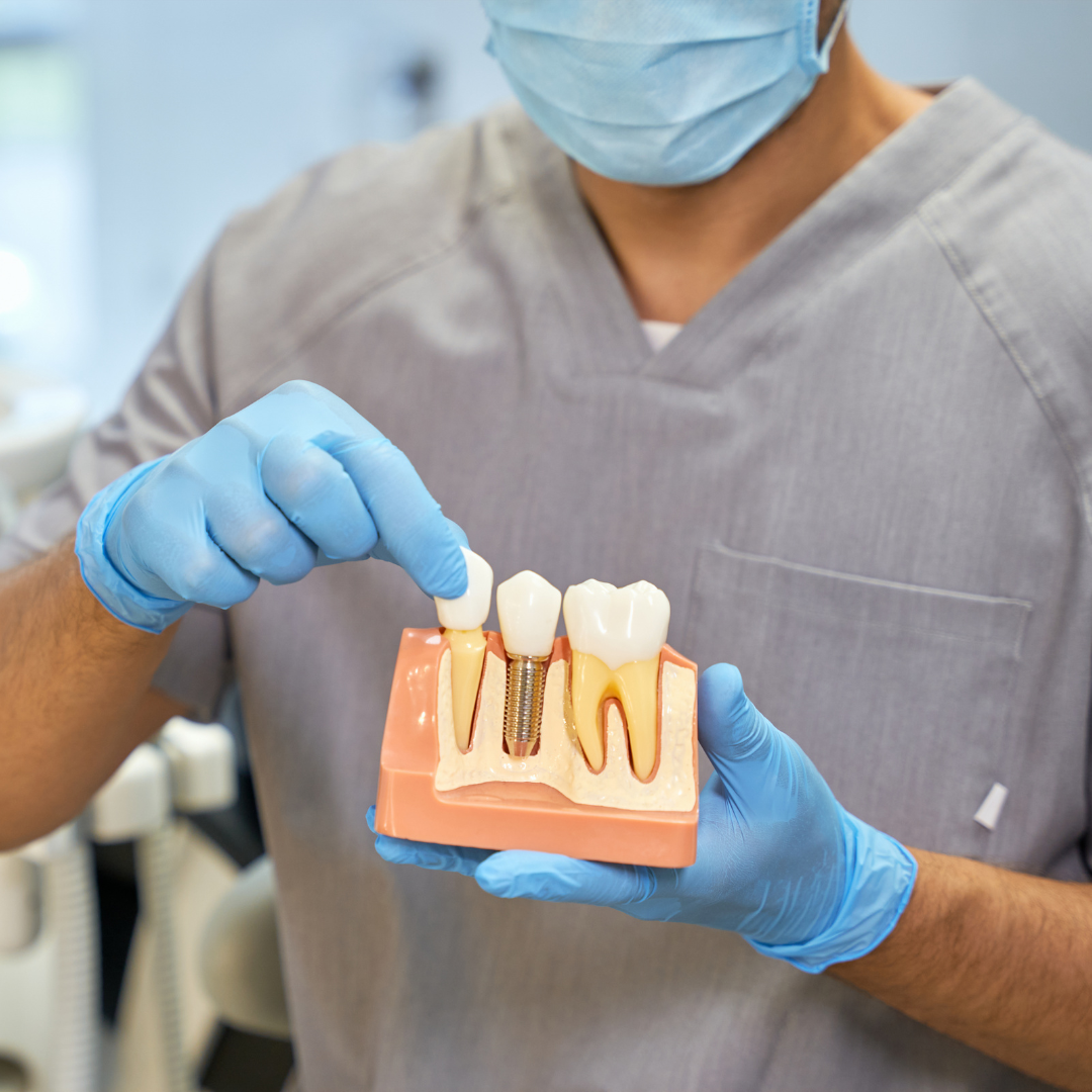 A dentist wearing gloves holds a dental implant visual